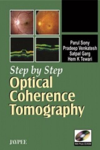 Kniha Step by Step: Optical Coherence Tomography Parul Sony