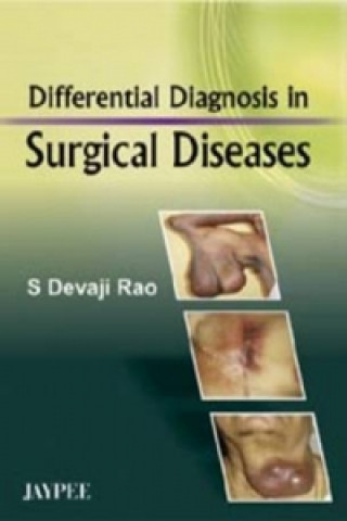 Carte Differential Diagnosis in Surgical Diseases Devaji S. Rao