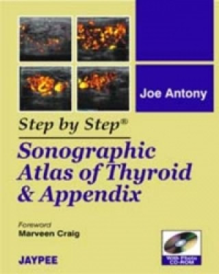 Carte Step by Step: Sonographic Atlas of Thyroid and Appendix Joe Antony