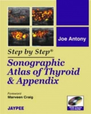 Libro Step by Step: Sonographic Atlas of Thyroid and Appendix Joe Antony