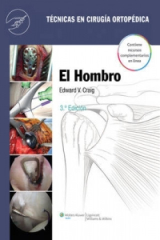Könyv Tecnicas en cirugia ortopedica. El hombro Edward V. Craig