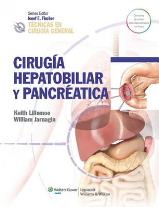 Carte Tecnicas en cirugia general. Cirugia hepatobiliar y pancreatica Keith D. Lillemoe