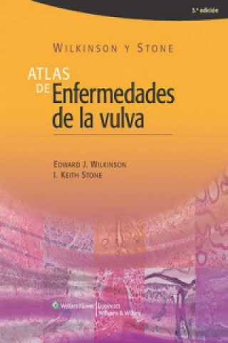 Könyv Atlas de enfermedades de la vulva Edward J. Wilkinson