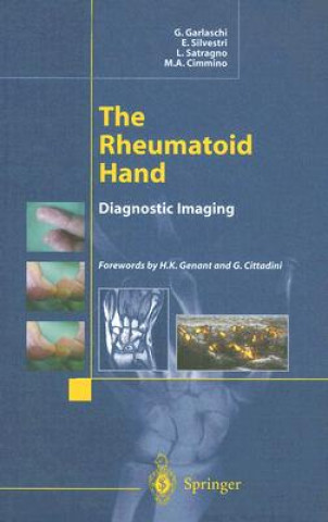 Książka Rheumatoid Hand G. Garlaschi