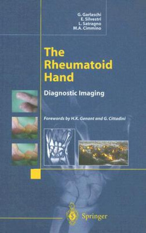 Buch Rheumatoid Hand G. Garlaschi