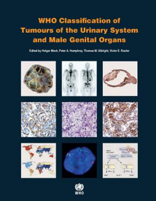 Könyv WHO classification of tumours of the urinary system and male genital organs International Agency for Research on Cancer