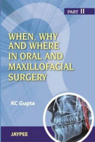 Kniha When, Why And Where In Oral And Maxillofacial Surgery: Prep Manual For Undergraduates And Postgraduates Part II K. C. Gupta