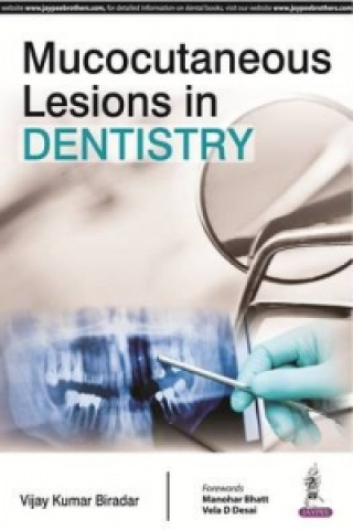 Βιβλίο Mucocutaneous Lesions in Dentistry Vijay Kumar Biradar