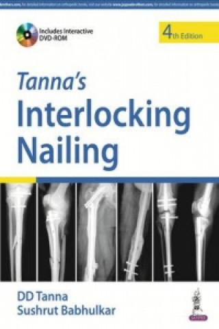 Könyv Tanna's Interlocking Nailing D. D. Tanna