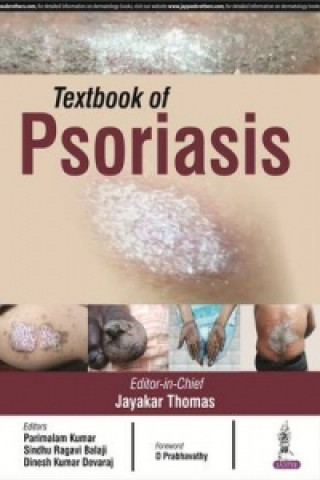 Knjiga Textbook of Psoriasis Jayakar Thomas