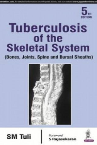 Carte Tuberculosis of the Skeletal System Sm Tuli