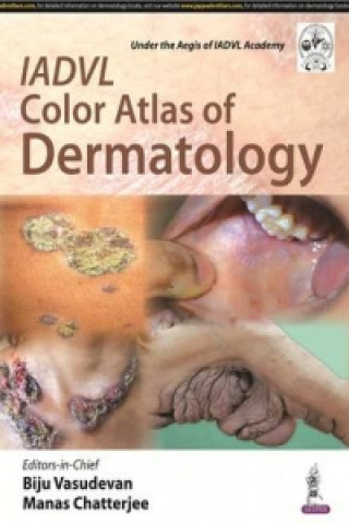 Carte IADVL Color Atlas of Dermatology Manas Chatterjee