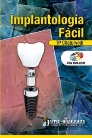 Книга Implantologia Facil T. P. Chaturvedi