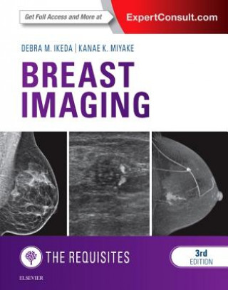 Kniha Breast Imaging: The Requisites Debra Ikeda