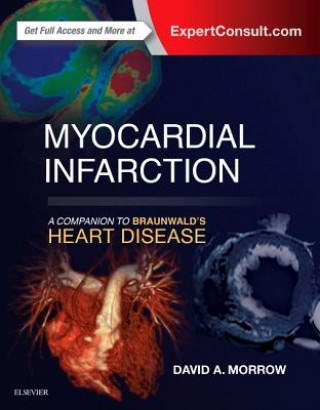 Könyv Myocardial Infarction: A Companion to Braunwald's Heart Disease David A Morrow