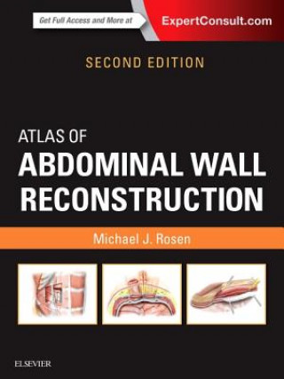 Kniha Atlas of Abdominal Wall Reconstruction Michael J. Rosen