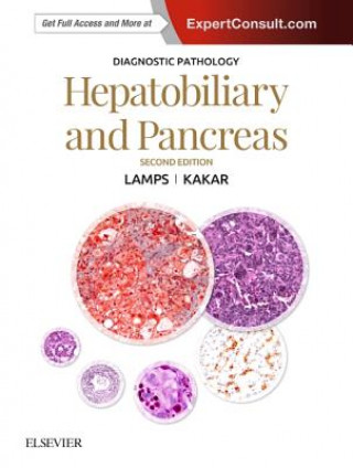 Książka Diagnostic Pathology: Hepatobiliary and Pancreas Laura Webb Lamps