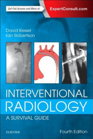 Könyv Interventional Radiology: A Survival Guide David Kessel