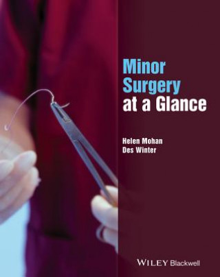 Buch Minor Surgery at a Glance Helen Mohan