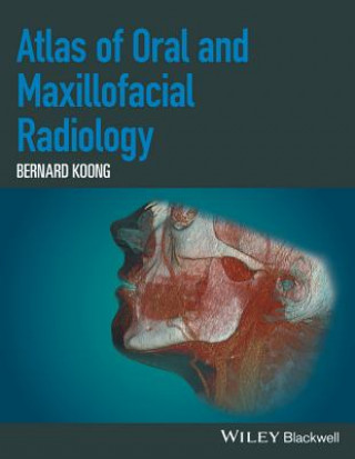 Книга Atlas of Oral and Maxillofacial Radiology Bernard Koong