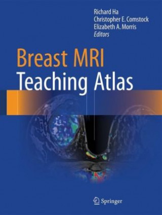 Carte Breast MRI Teaching Atlas Richard Ha