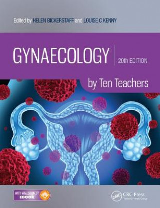 Kniha Gynaecology by Ten Teachers Ash Monga