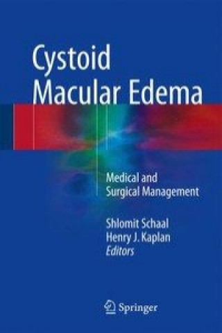 Kniha Cystoid Macular Edema Shlomit Schaal