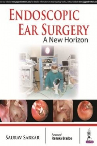 Buch Endoscopic Ear Surgery Saurav Sarkar