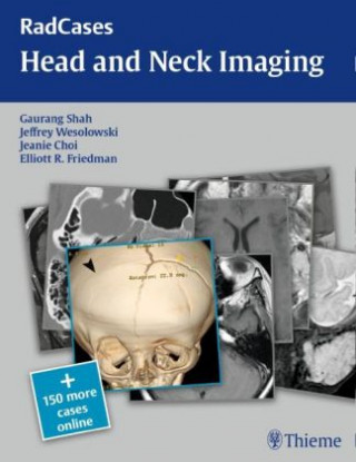 Kniha RadCases Head and Neck Imaging Gaurang Vrindavan Shah