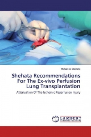 Carte Shehata Recommendations For The Ex-vivo Perfusion Lung Transplantation Mohamed Shehata