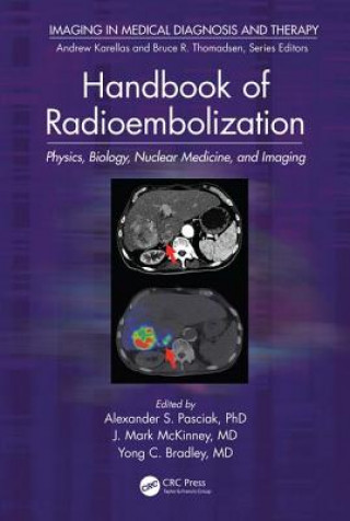 Kniha Handbook of Radioembolization Alexander S Pasciak