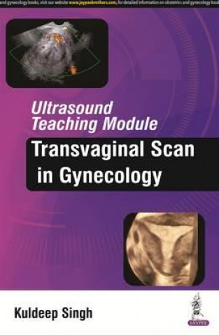 Kniha Ultrasound Teaching Module: Transvaginal Scan in Gynecology Kuldeep Singh