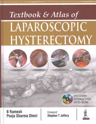Книга Textbook & Atlas of Laparoscopic Hysterectomy (Without DVD-ROOM) B. Ramesh