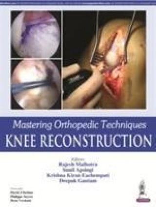 Kniha Mastering Orthopedic Techniques: Knee Reconstruction Rajesh Malhotra