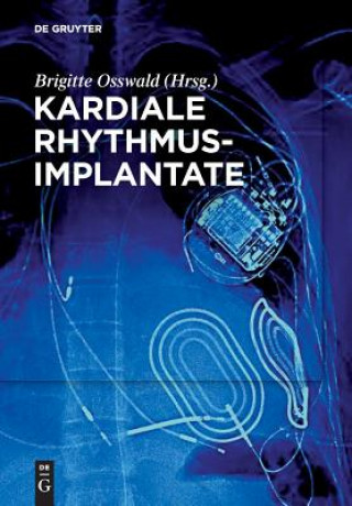 Könyv Kardiale Rhythmusimplantate Brigitte Osswald