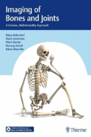 Книга Imaging of Bones and Joints Klaus Bohndorf