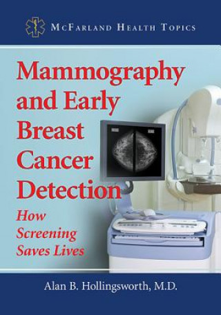 Könyv Mammography and Early Breast Cancer Detection Alan B. Hollingsworth