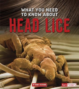 Könyv What You Need to Know About Head Lice Nancy Dickmann