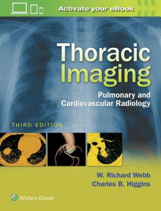 Książka Thoracic Imaging Robert Webb