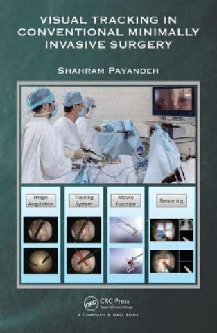 Livre Visual Tracking in Conventional Minimally Invasive Surgery Shahram Payandeh