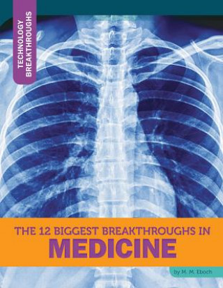 Kniha The 12 Biggest Breakthroughs in Medicine M. M. Eboch