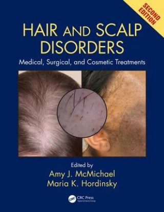 Kniha Hair and Scalp Disorders 