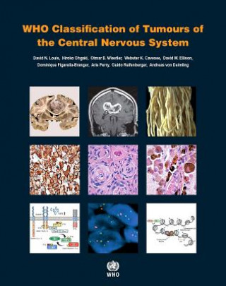 Kniha Who Classification of Tumours of the Central Nervous System International Agency for Research on Cancer