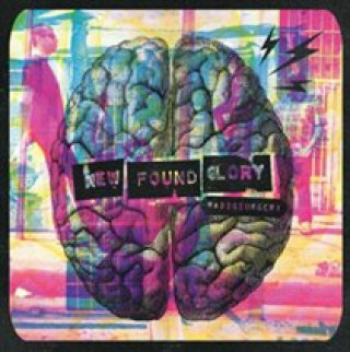 Аудио Radiosurgery New Found Glory