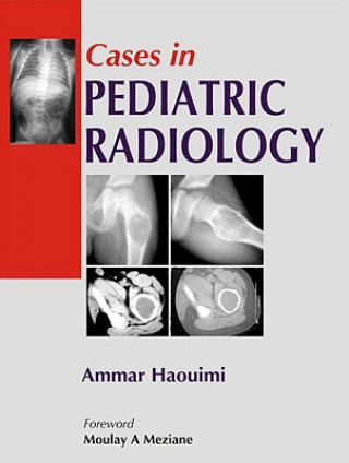 Knjiga Cases in Pediatric Radiology Haouimi Ammar