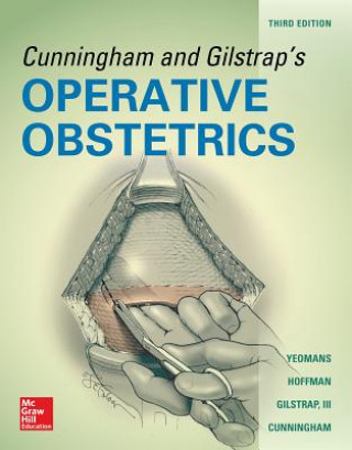 Carte Cunningham and Gilstrap's Operative Obstetrics, Third Edition F. Cunningham