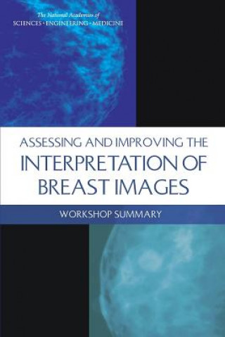 Kniha Assessing and Improving the Interpretation of Breast Images: Workshop Summary National Cancer Policy Forum