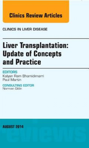 Könyv Liver Transplantation: Update of Concepts and Practice, An Issue of Clinics in Liver Disease Kalyan Ram Bhamidimarri