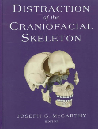 Carte Distraction of the Craniofacial Skeleton P. Tessier