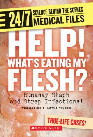 Könyv Help! Whats Eating My Flesh?: Runaway Staph and Strep Infections! Thomasine E. Lewis Tilden